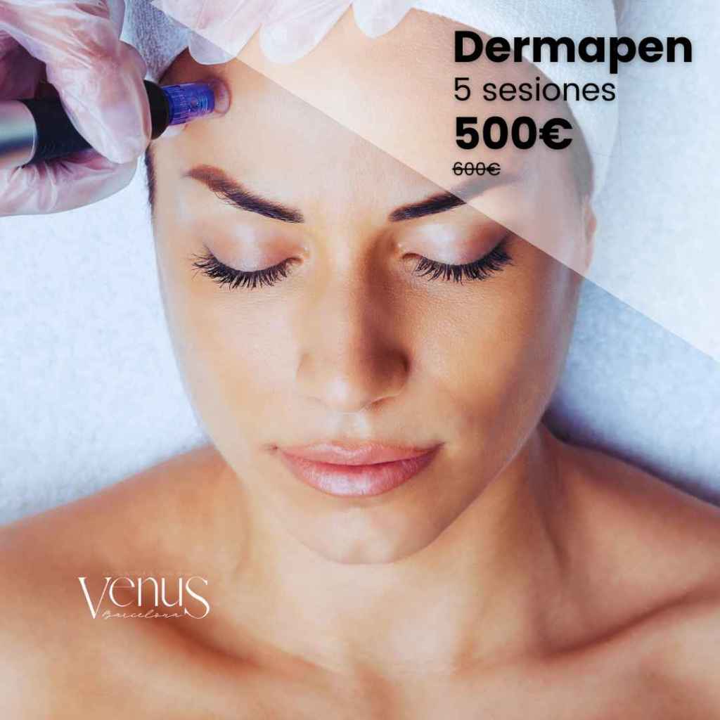 oferta dermapen