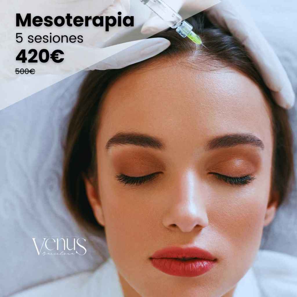 oferta mesoterapia